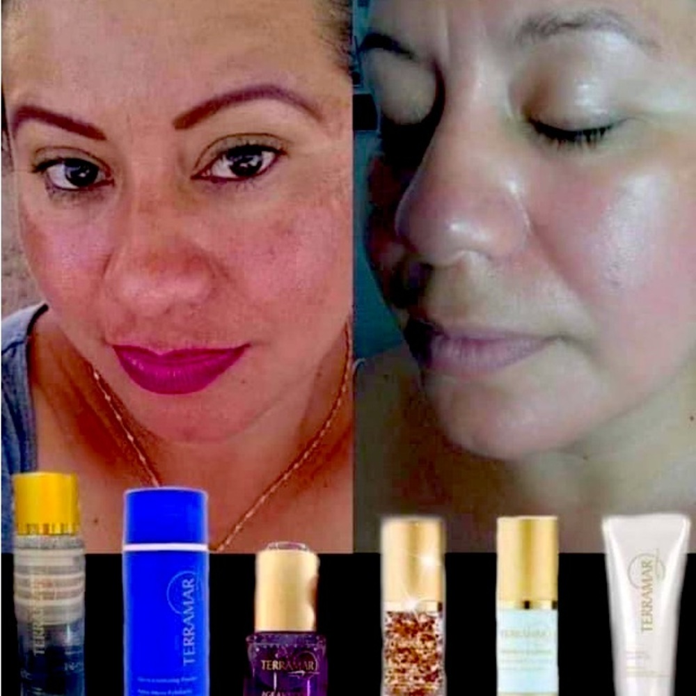 Son productos Para manchas